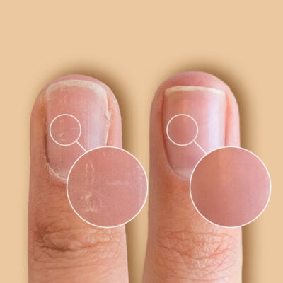 SolarOil Nail & Cuticle Treatment 7,3 ml