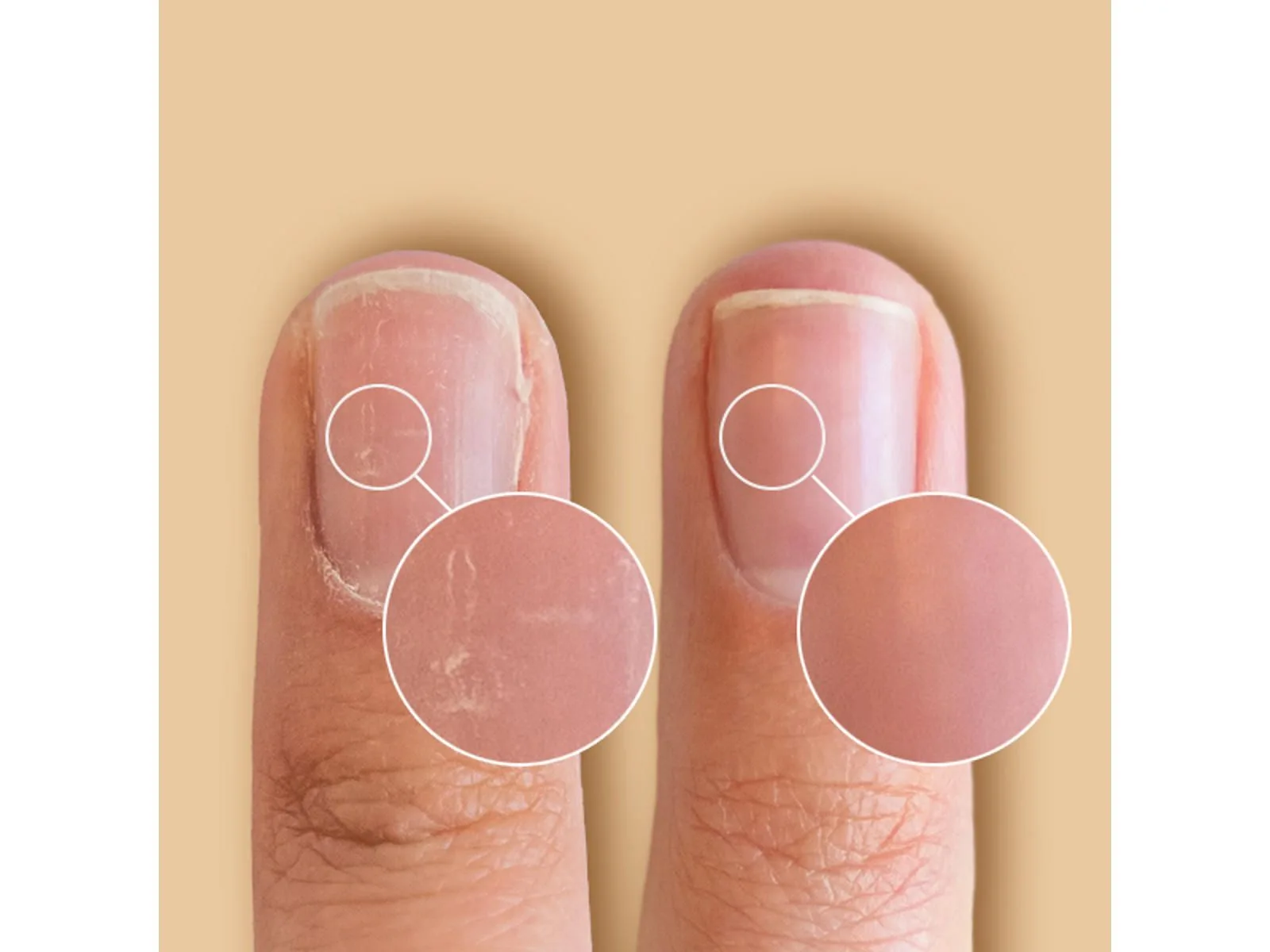Cnd SolarOil™ Nail & Cuticle Oil 68 ml - Image 2